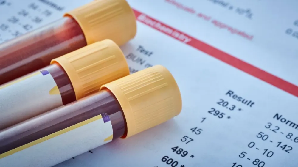 Prolaktin hormonu nedir?