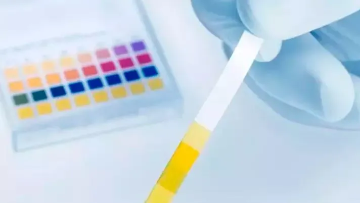 drarda Protein Kaçağı Nedir, Neden Olur? 