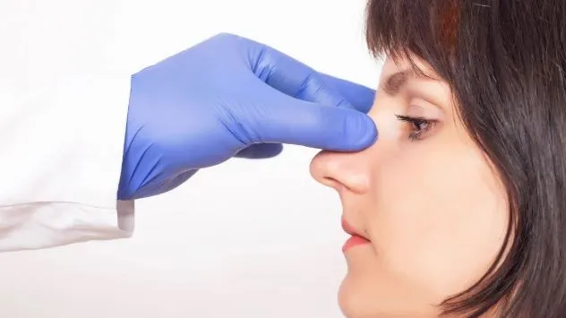 Burun estetiği yaş sınırı var mı? Burun estetiği kaç günde iyileşir?