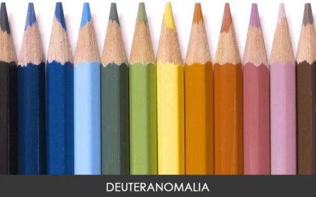Renk Körlüğü Belirtileri Nelerdir?