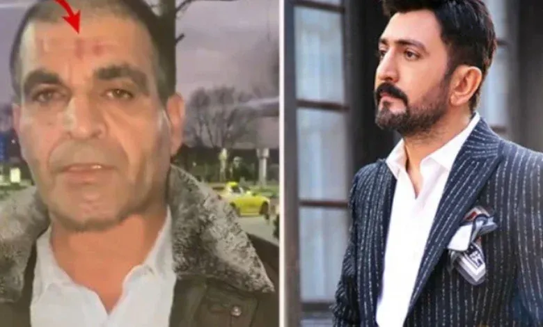 Ferman Toprak’a İşçi Darp İddiası: Canımızı Zor Kurtardık!