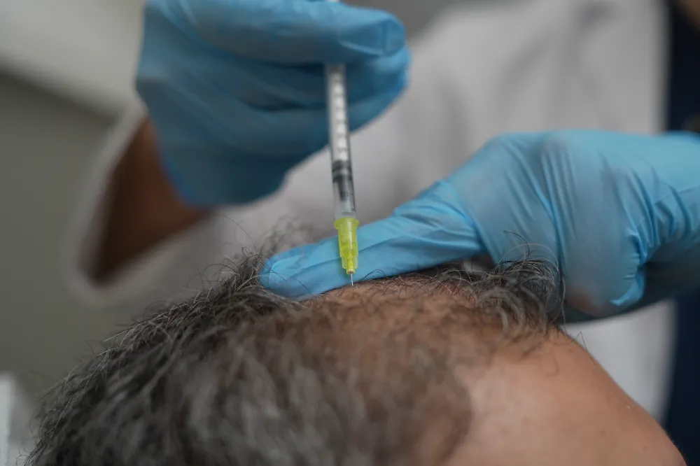 Dökülen saçlar vücudun bir alarmı olabilir