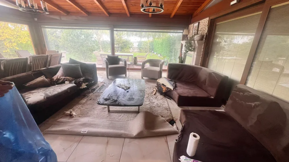 Dekoratif Şömine Patladı: 41 Yaşındaki Kadın Vücudunun Yüzde 30’unu Yaktı