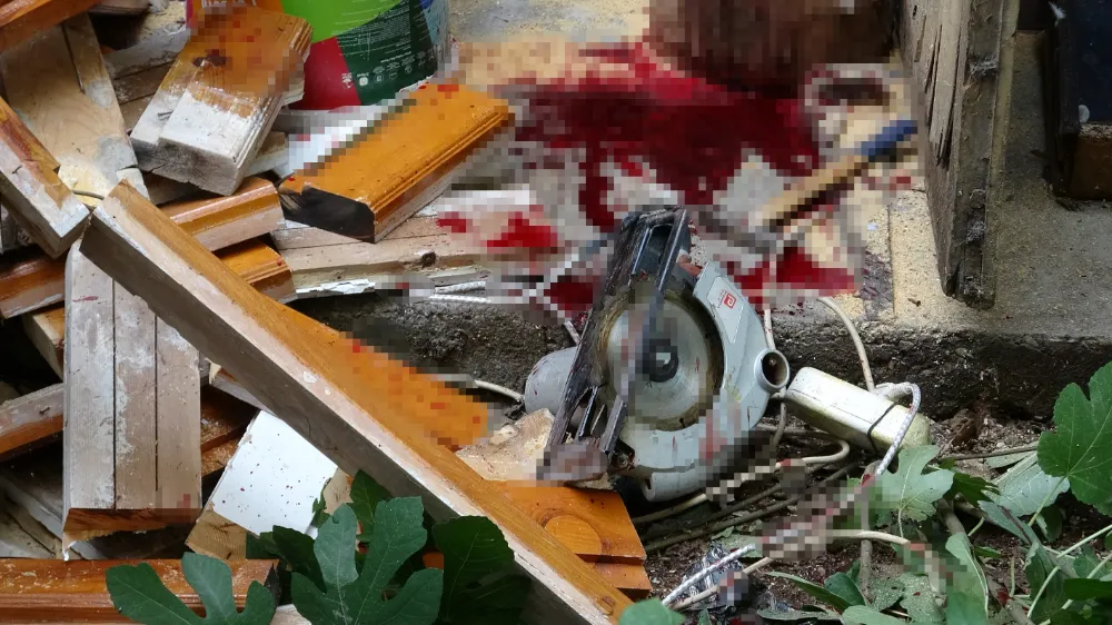 Elektrikli testere kazası: Yaşlı adam ağır yaralandı, torunu gözyaşlarına boğuldu