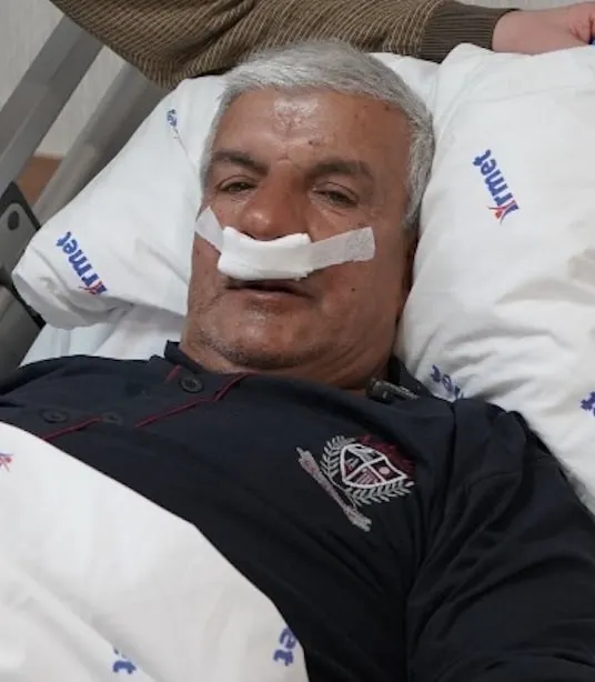 Tekirdağ’da 65 yaşındaki adamın burnundan 100 gramlık taş çıkarıldı