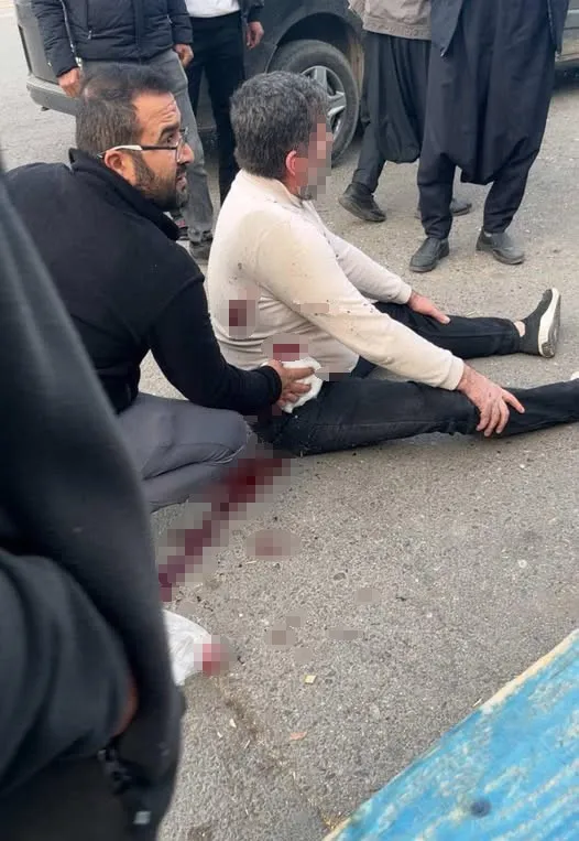 Şanlıurfa’da Bıçaklı Kavga: 1 Ağır Yaralı