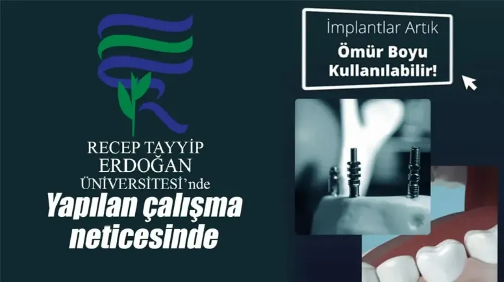 Recep Tayyip Erdoğan Üniversitesi’nden Devrim Niteliğinde Buluş: Ömür Boyu Kullanılabilen Dental İmplantlar