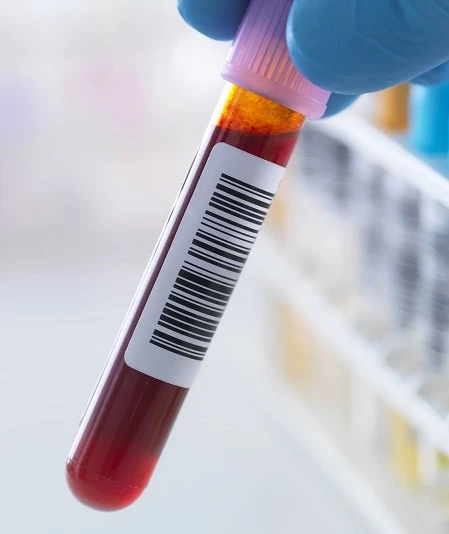 HbA1c Nedir ? Neden Önemlidir ?
