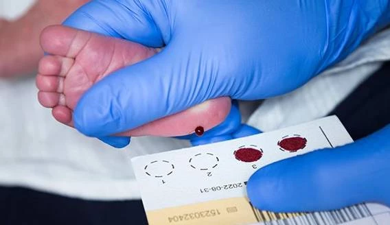 Topuk kanı taraması nedir? Bebeklerden neden topuk kanı alınır?