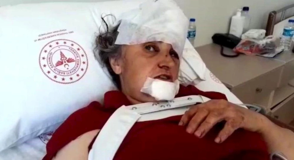 ŞOFÖR, OTOBÜS ARIZALANINCA MİNİBÜSÜ DEVRALMIŞ! TRABZON