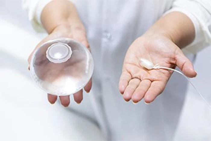 Obezite Tedavisinde Yeni Bir Adım: Yutulabilen Mide Balonları